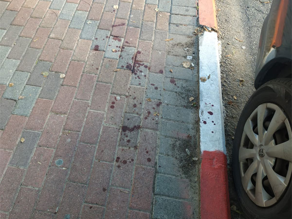 זירת התקרית באשדוד