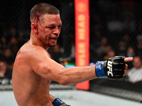 קיבל סוף סוף קרב. דיאס (GETTY)