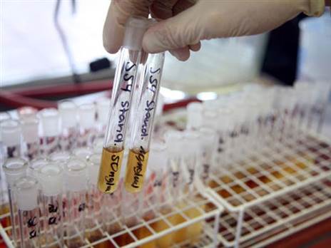 הליך לא מורכב, אך האם ישתנה בקרוב? (Getty)