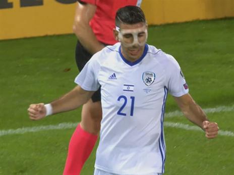 "איבדנו את השליטה במשחק". טיבי