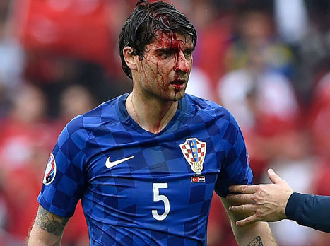 למרות הפגיעה הוא צפוי לפתוח. צ'ורלוקה (getty)