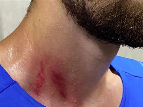 שחקני מארסיי הוכו