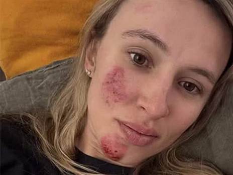 קסיה ניוויאדומה | צילום: אינסטגרם