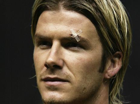 הנזק המפורסם ביותר מ'מייבש השיער' של פרגי. בקהאם