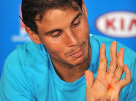 נדאל והפצע ביד. יוכל להמשיך? (gettyimages)