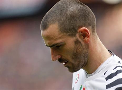 גם בונוצ'י נפצע (GETTY)