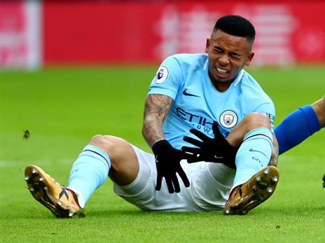 ז'סוס. מכה כואבת לסיטיזנס (getty)