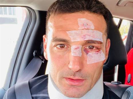 ארגנטינה יכולה להיות רגועה (GETTY)