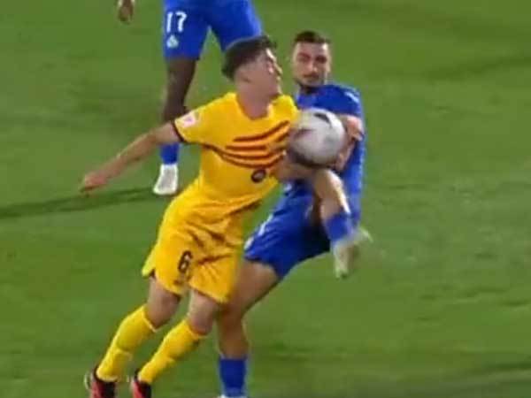 נגיעת היד המדוברת