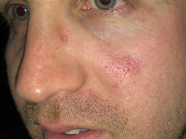 אוהד חולון יתלונן נגד מנהל הפועל ת"א