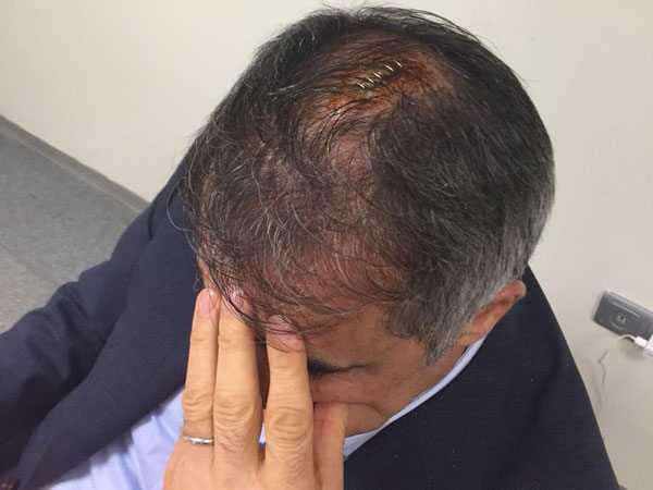 גונש לאחר הפגיעה